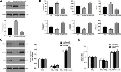 Dihydroquercetin Attenuates Silica-Induced Pulmonary Fibrosis by Inhibiting Ferroptosis Signaling Pathway